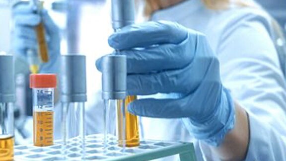A lab technician working on chemicals with several test tubes in front of her